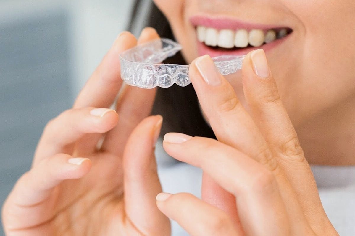 Kosten für Invisalign unsichtbare Zahnspange